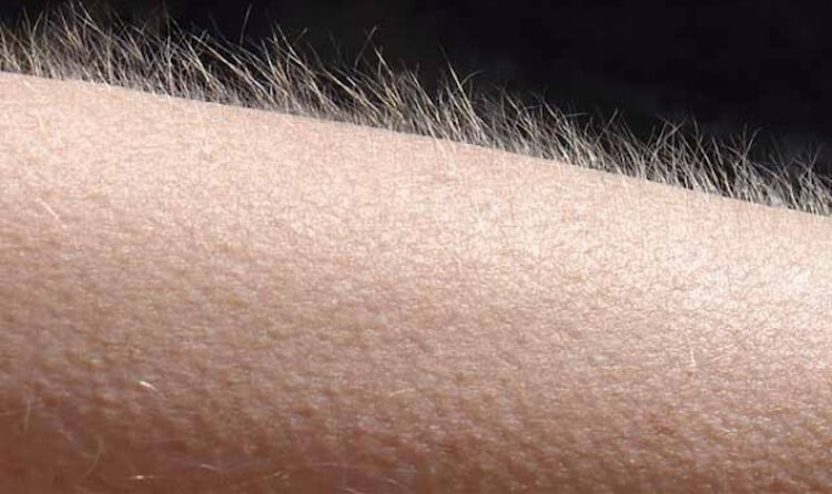 Представляете, если волосяной покров будет в 10 раз гуще? Фото.