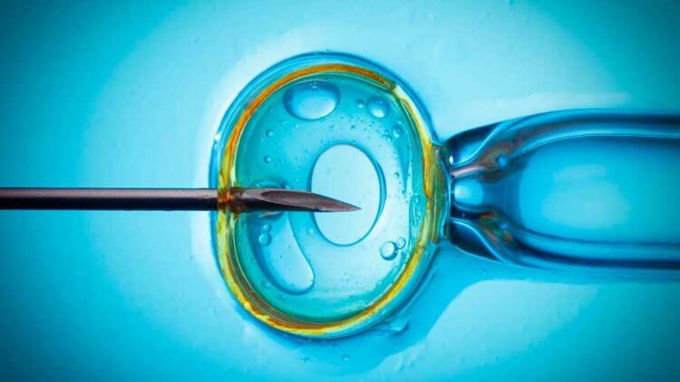 Как проведение ЭКО влияет на пол ребенка? ИКСИ — один из методов искусственного оплодотворения, при котором игла со сперматозоидом вводится непосредственно в яйцеклетку. Фото.
