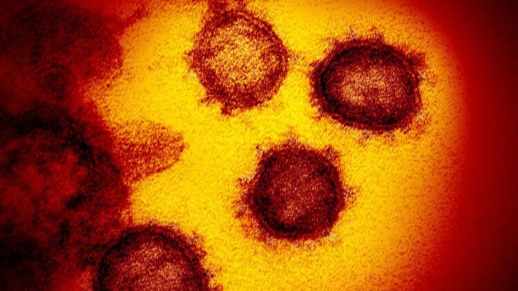 Насколько заразен CoVID-19? Как вы думаете, что изображено на этой фотографии – коронавирус или вирус сезонного гриппа? Поделитесь ответом в комментариях к этой статье. Фото.