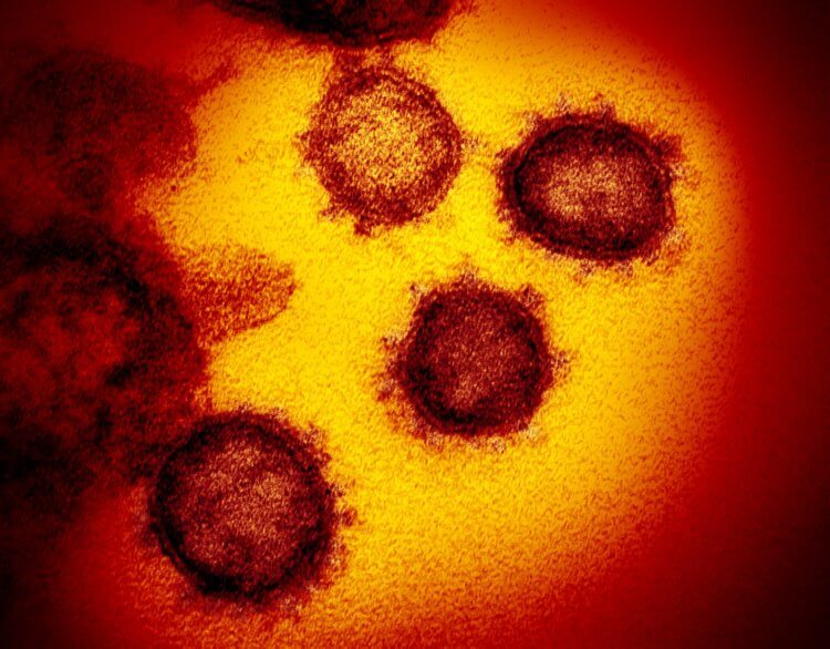 Новый коронавирус – загадка для ученых. Так CoVID-19 выглядит под микроскопом. Фото.