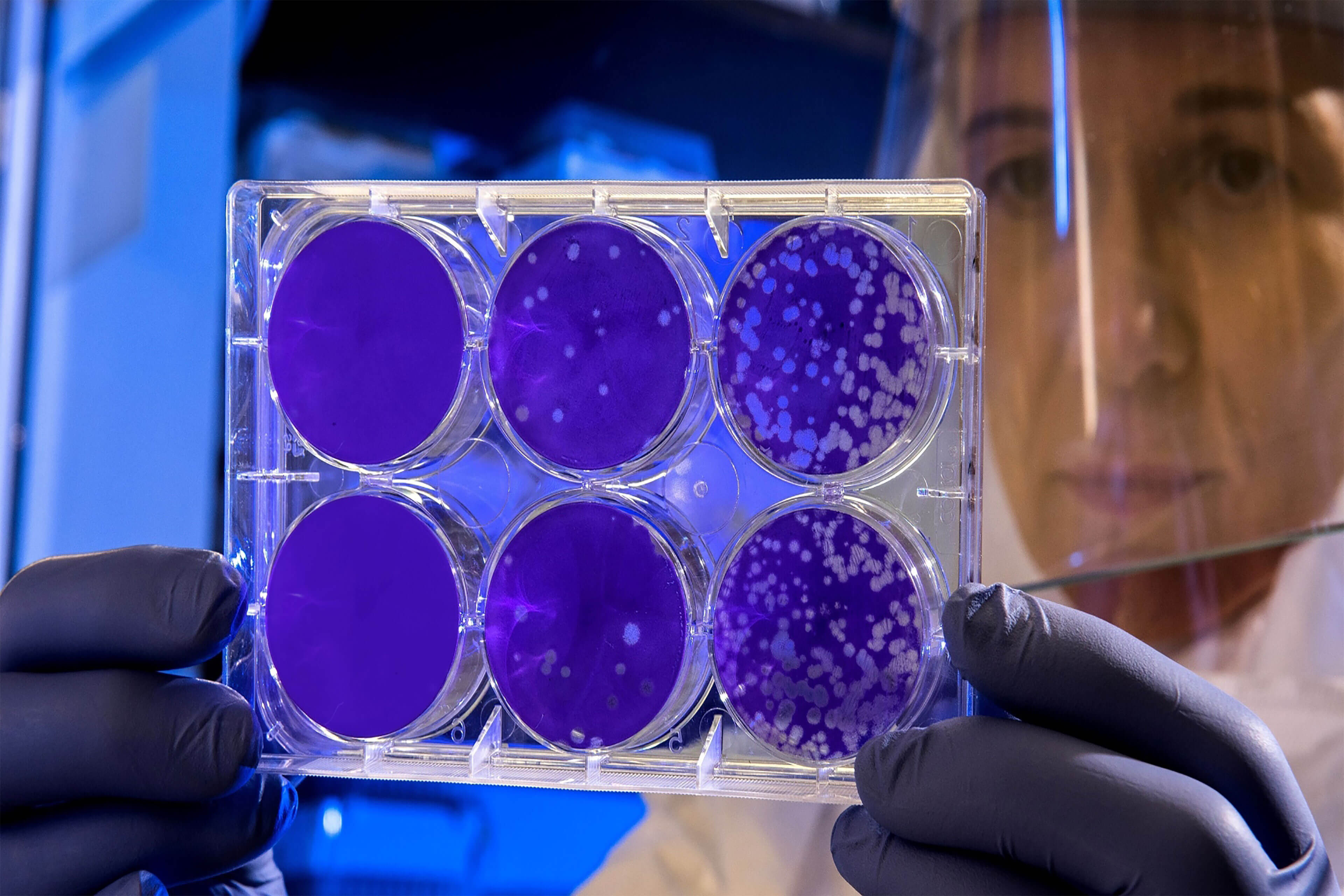 Откуда появилась информация о повторном заражении CoVID-19? Самое главное, что нужно помнить о CoVID-19 – это то, что данных о нем сегодня недостаточно. Откуда появилась информация о повторном заражении CoVID-19? Самое главное, что нужно помнить о CoVID-19 – это то, что данных о нем сегодня недостаточно. Фото.