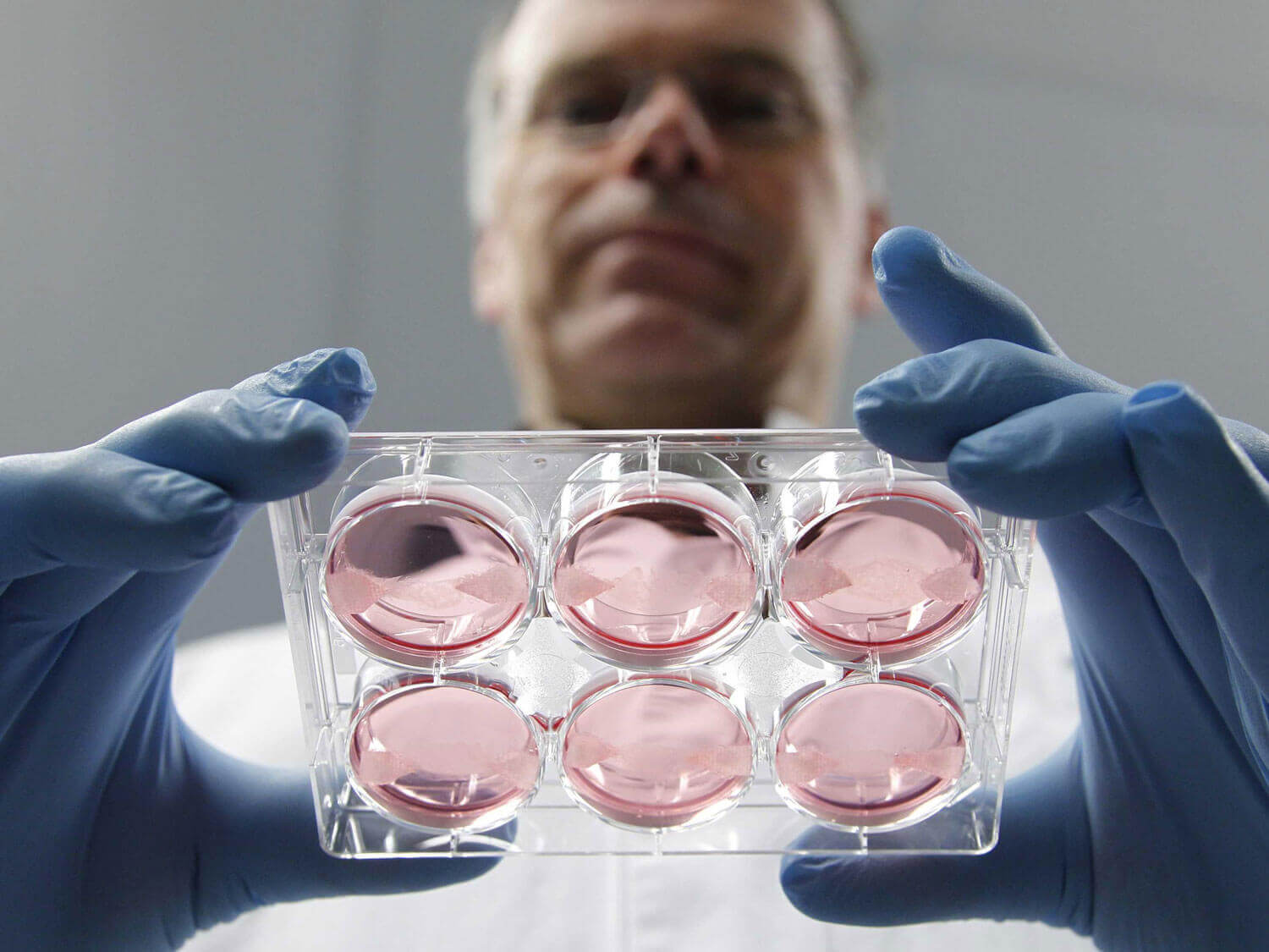 Дети, рожденные с помощью ЭКО особенные? Считается, что вероятность стать родителями близнецов с помощью ЭКО увеличивается. Фото.