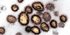 Что коронавирус делает с организмом человека? Фото.