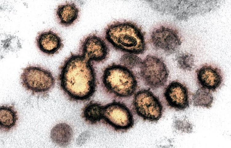 Что коронавирус делает с организмом человека? Так под микроскопом выглядит вирус, который стремительно меняют нашу жизнь. Фото.