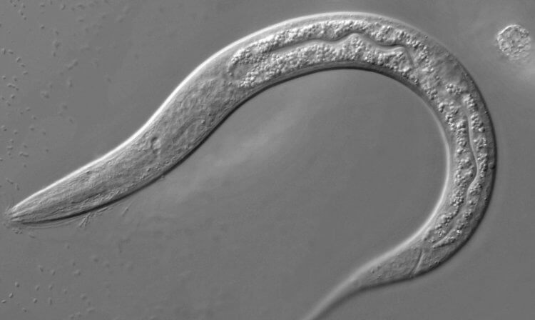 Черви способны находить у людей 15 видов рака. Так выглядят круглые черви вида Caenorhabditis elegans. Фото.