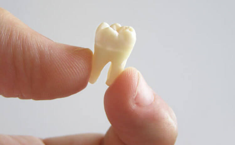 Что такое молочные зубы. Первый зуб самый неприятный, но самый важный. Фото.