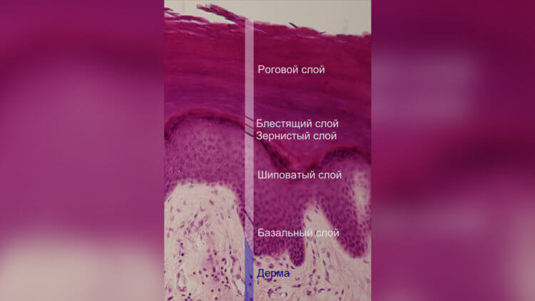 Строение кожи человека. Фиолетовым цветом показаны слои, из которых состоит эпидермис человека. Фото.