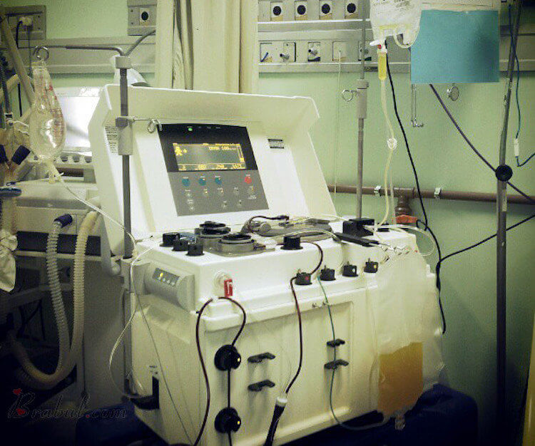 Как получают плазму крови. Машина, которая выделяет плазму из крови, и возвращает эритроциты донору. Фото.