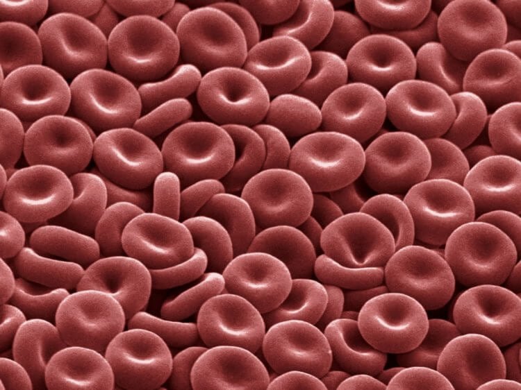 Группы крови человека: чем отличаются и почему их нельзя смешивать. В мире признано 4 группы крови. Фото.