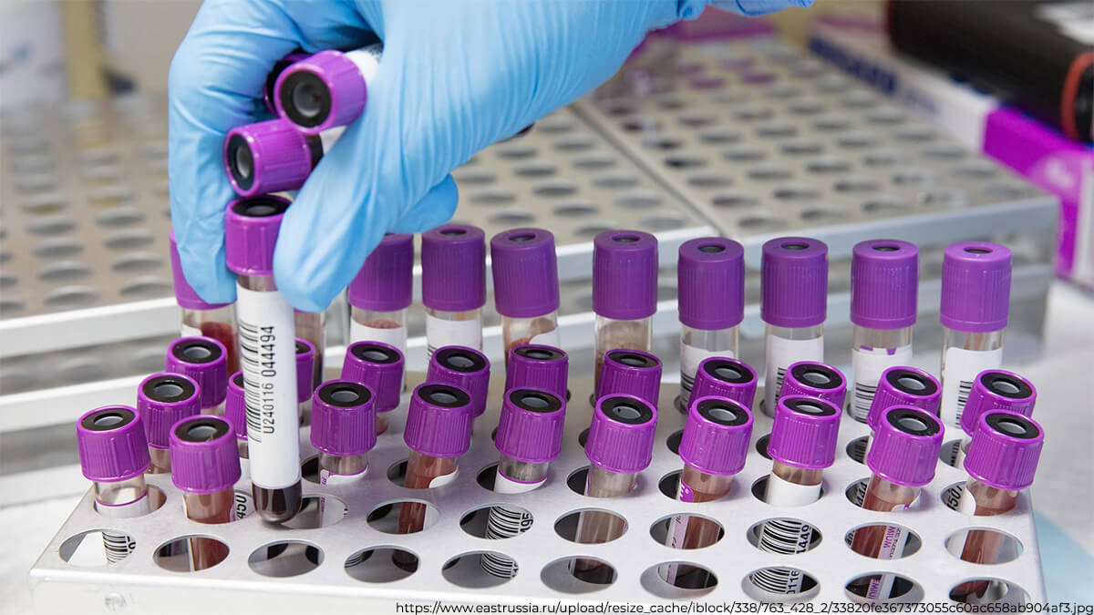 Кровь инфицированных пациентов, как полагают, свертывается в легких и ногах. Фото.