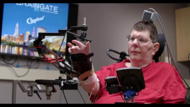Ученые читают мысли. Частично парализованный мужчина управляет роботизированной конечностью с помощью устройства Braingate. Фото.