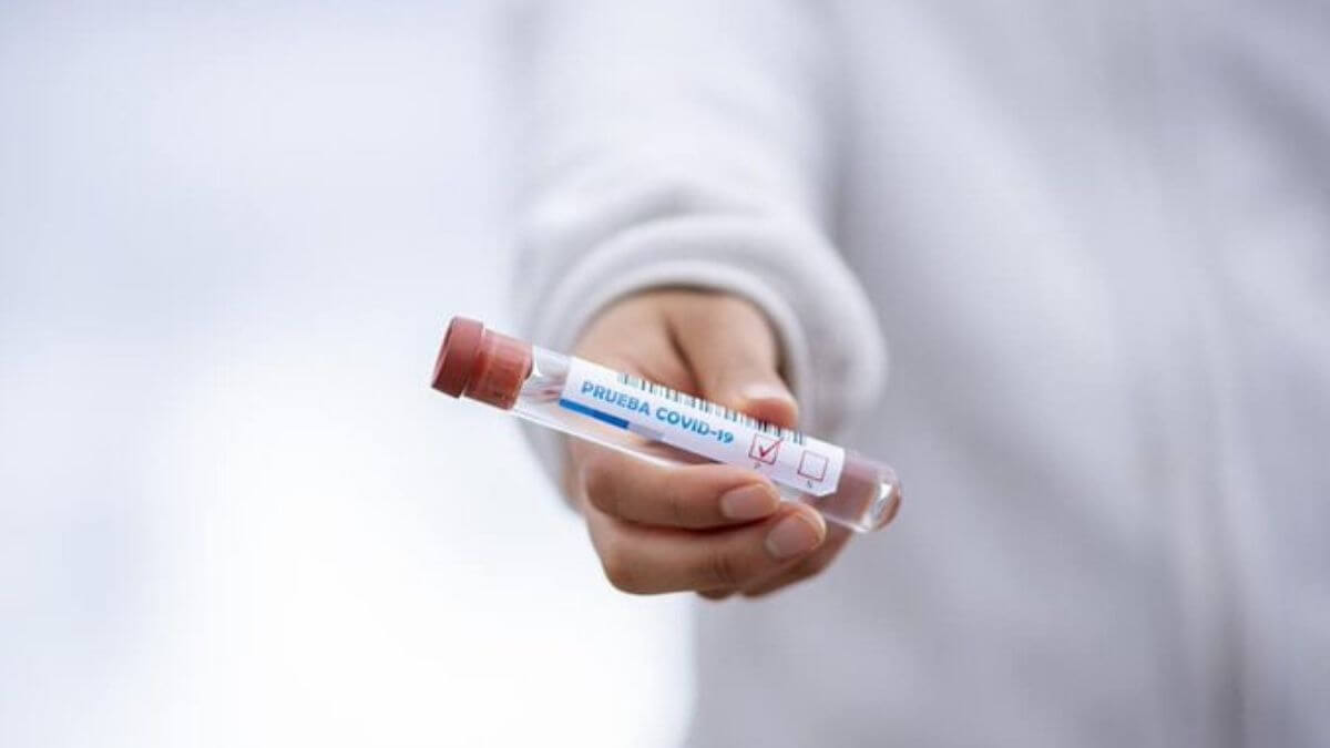 Ученые вплотную приблизились к созданию вакцины от коронавируса. Фото.