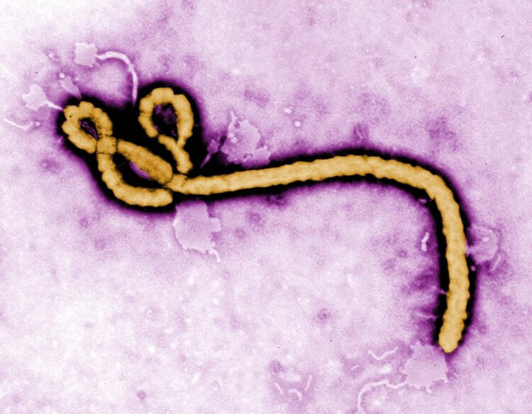 Вирусные войны. А так при ближайшем рассмотрении выглядит вирус Эбола. Фото.