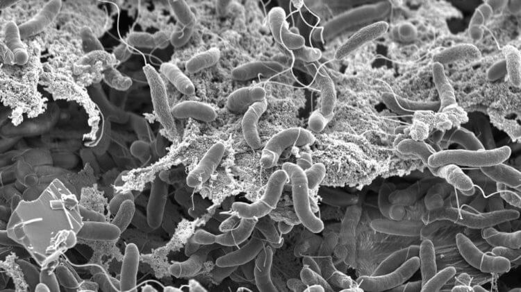 Возбудитель холеры — Vibrio cholerae. Vibrio cholerae под микроскопом. Фото.