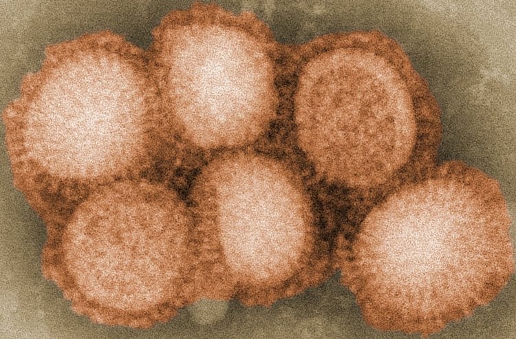 Свиной грипп — вирус H1N1. «Свиной грипп» под микроскопом. Фото.