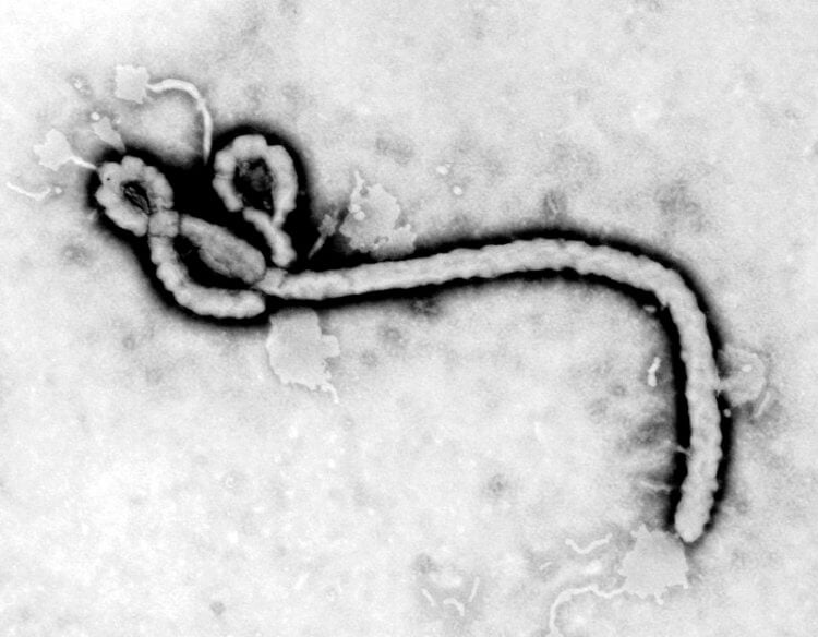 Вирус Эбола. Вирус Эбола выглядит интереснее остальных. Фото.