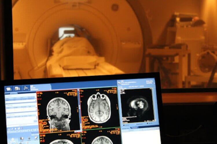 Влияние языков на мозг. Примерно так происходит сканирование мозга через фМРТ. Фото.