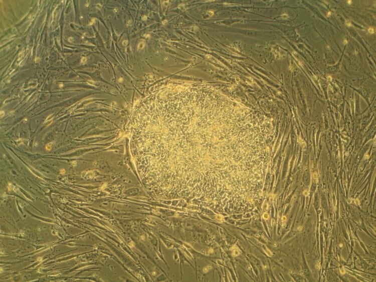 Искусственно выращенные яйцеклетки. Группа ученых смогла превратить стволовые эмбриональные клетки мыши в клетки, функционирующие как сперматозоиды. Фото.