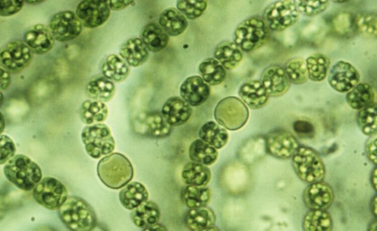 Что едят бактерии? Цианобактерии под микроскопом. Фото.