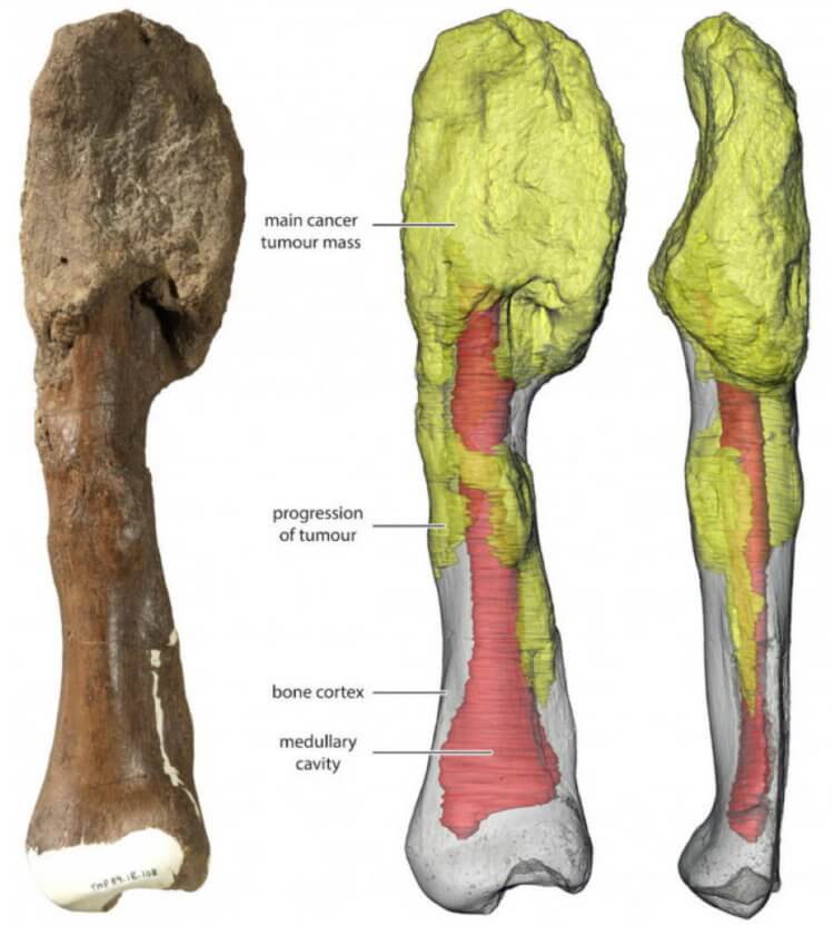 Рак костей у динозавров. 3D-модель поврежденных костей динозавра. Фото.
