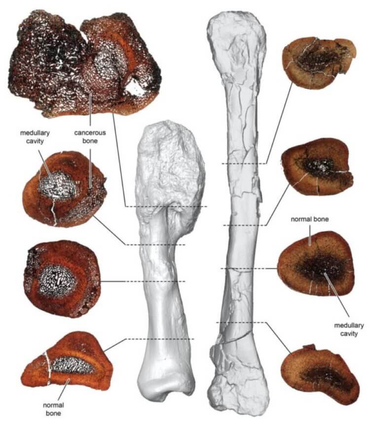 Рак костей у динозавров. Слева показаны срезы костей, пораженных остеосаркомой. Справа — срезы здоровых костей. Фото.