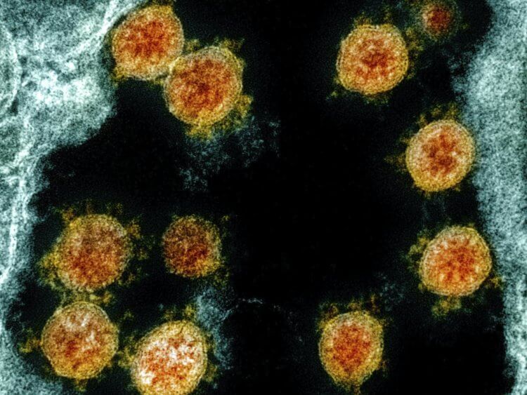 Отличается ли новый коронавирус от старого? Штамм нового коронавируса отличается от исходного. Фото.