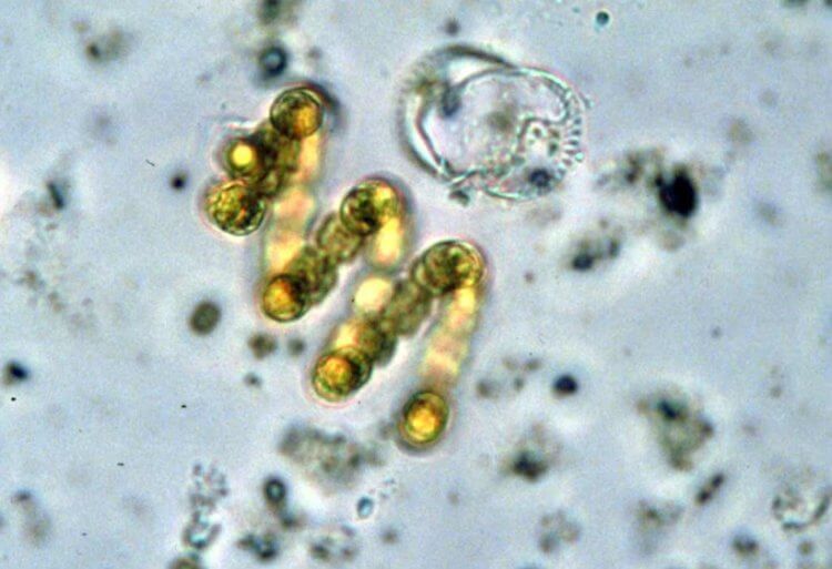 Опасные бактерии. Цианобактерии под микроскопом. Фото.