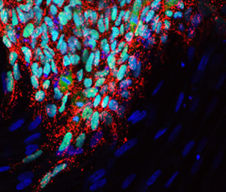Чем это отличается от ЭКО. Колония индуцированных плюрипотентных стволовых клеток, используемых для лечения редкого генетического заболевания — анемии Фанкони. Фото.