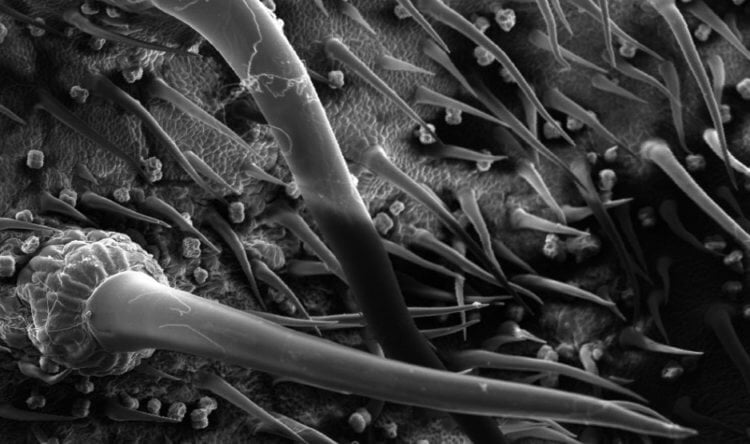 Строение опасных растений. Трихомы Гимпи-гимпи под микроскопом. Фото.