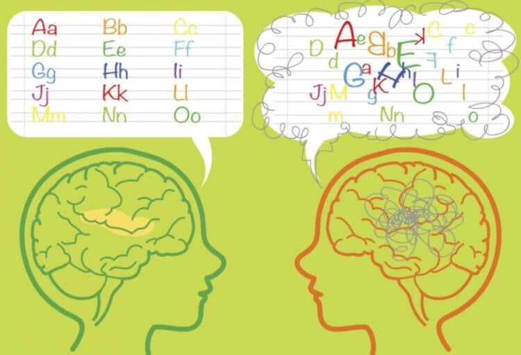 Что такое дислексия? Мозги здоровых людей и дислексиков работают по-разному. Фото.