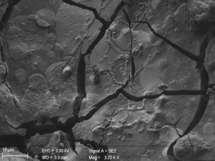 Археологическая находка в Италии. Сохранившийся фрагмент мозга под микроскопом. Фото.