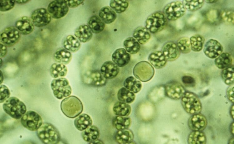 Ядовитые водоросли. Цианобактерии под микроскопом. Фото.