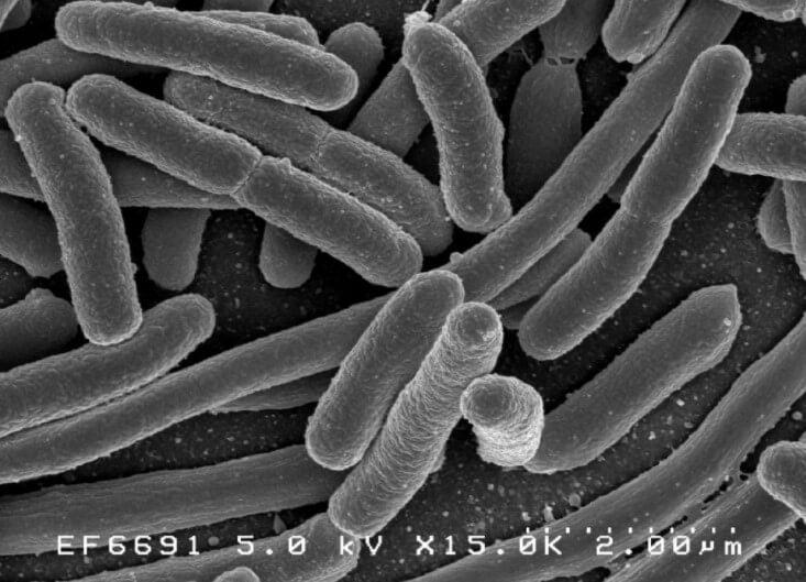 Бактерии на мыле. Кишечная палочка под микроскопом. Фото.