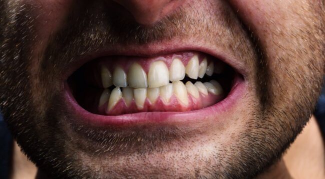 Почему зубы — это не кости? Фото.