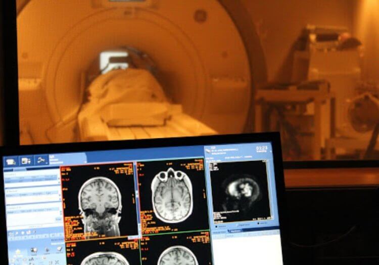 Диагностика болезни Паркинсона. Самый надежный способ выявить болезнь Паркинсона — направить человека на МРТ. Фото.