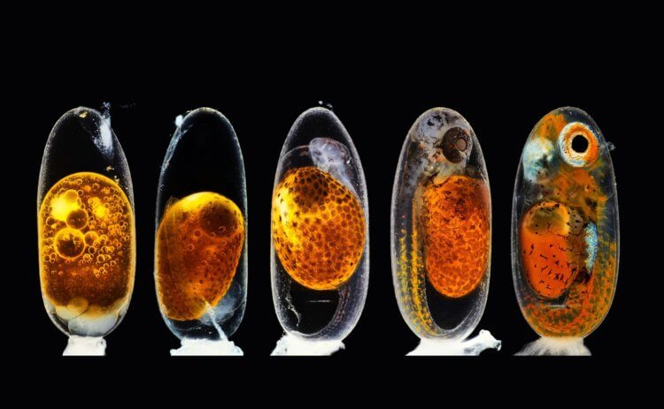 Эмбрион рыбы-клоуна. Фотография эмбрионального развития зародыша рыба-клоуна заняла второе место в 46-м ежегодном конкурсе Nikon Small World Photomicrography Competition. Фото.