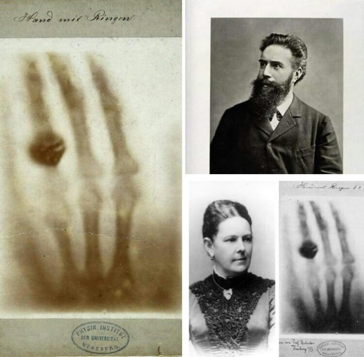 Внутри тела человека. Портрет Вильгельма Рентгена, его жены Анны Берты Людвиг и рентген ее руки. Фото.