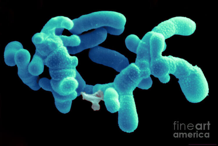 Кишечные бактерии и коронавирус. Bifidobacterium adolescentis и им подобные бактерии укрепляют человеческий иммунитет. Фото.