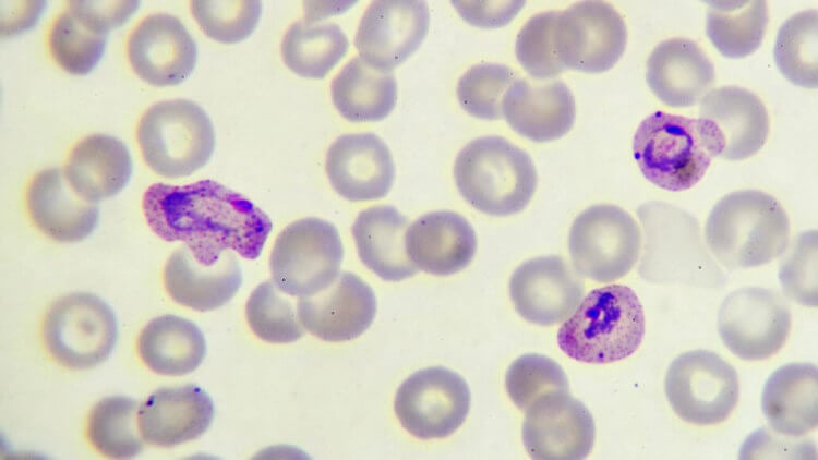 Как можно заразиться малярией. Передаваясь человеку через укус комара, вызывающий малярию паразит плазмодий (показан фиолетовым цветом) размножается в красных кровяных тельцах. Фото.
