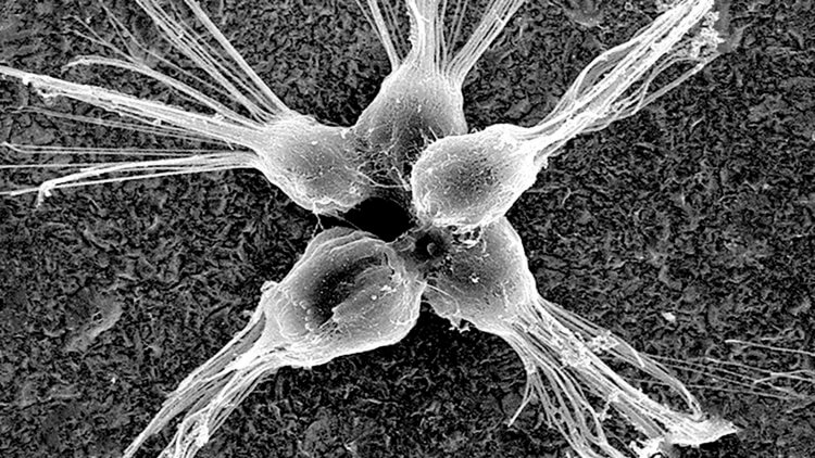 Обнаружены поедающие вирусы организмы. Что о них известно? Перед вами электронная микрофотография колонии хоанофлагеллятных розеток. Исследователи изучают, могут ли эти одноклеточные организмы питаться вирусами в Мировом океане. Фото.