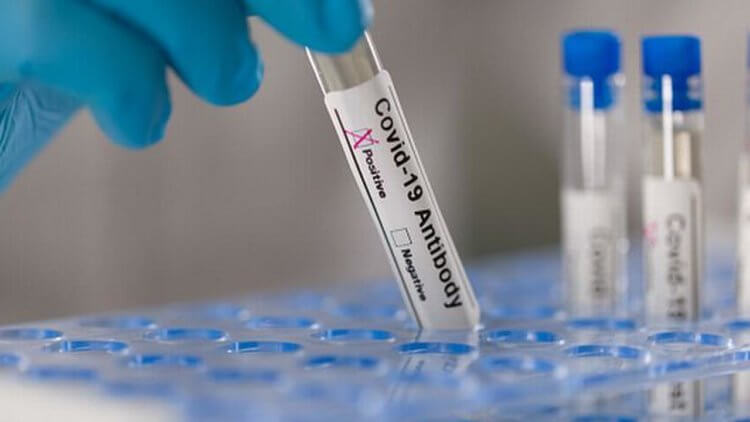 Чем отличаются антитела к коронавирусу и какой тест сдавать