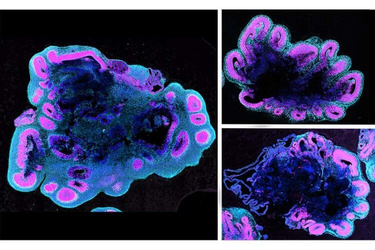 Зачем нам большой мозг? В возрасте пяти недель органоиды человеческого мозга (слева) намного больше, чем у гориллы (вверху справа) и шимпанзе (внизу справа). Фото.