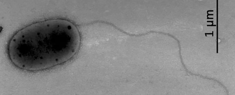 Новый вид бактерий на МКС. Также на МКС были найдены бактерии Methylobacterium jeotgali. Фото.