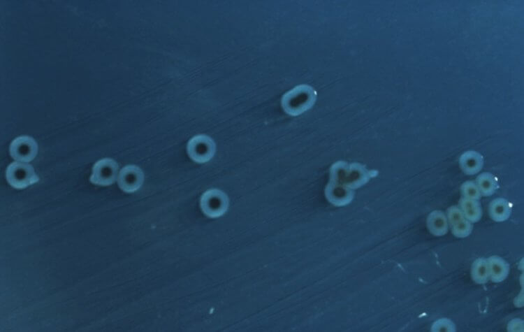Бактерии в космосе. Бактерии Salmonella enterica. Фото.