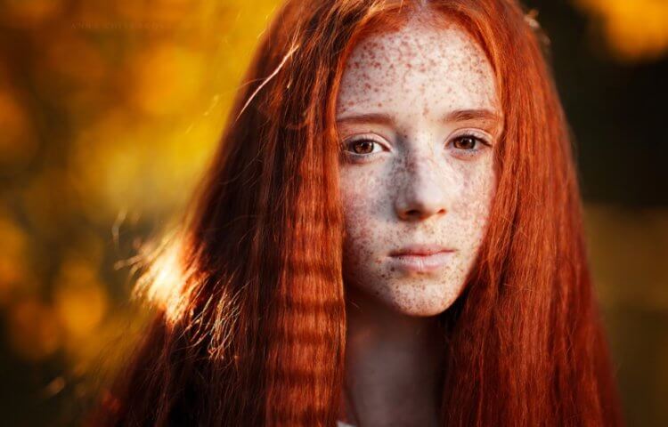 Почему рыжие люди не могут загореть и не чувствуют боли? Людей с настоящими рыжими волосами очень мало — всего около 2% от всего населения Земли. Фото.