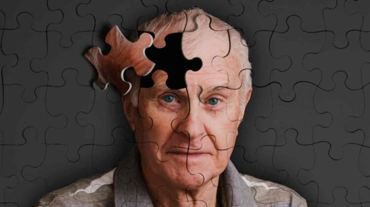 Опасность недостатка сна. Деменция является распространенной проблемой среди пожилых людей. Фото.