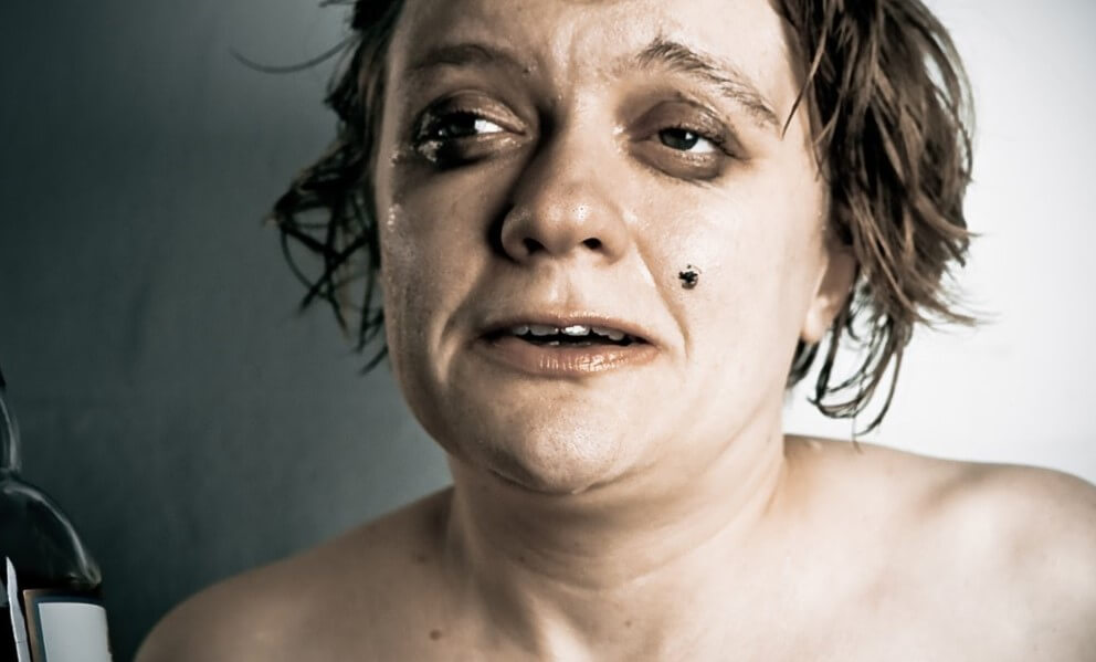 Улучшение состояния кожи. Алкоголь ужасно влияет на состояние кожи человека. Фото.