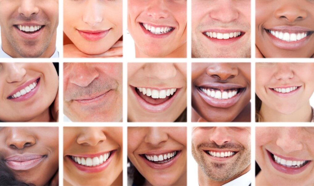 Восстановление здоровья зубов. Отказ от алкоголя улучшает состояние ваших зубов. Фото.