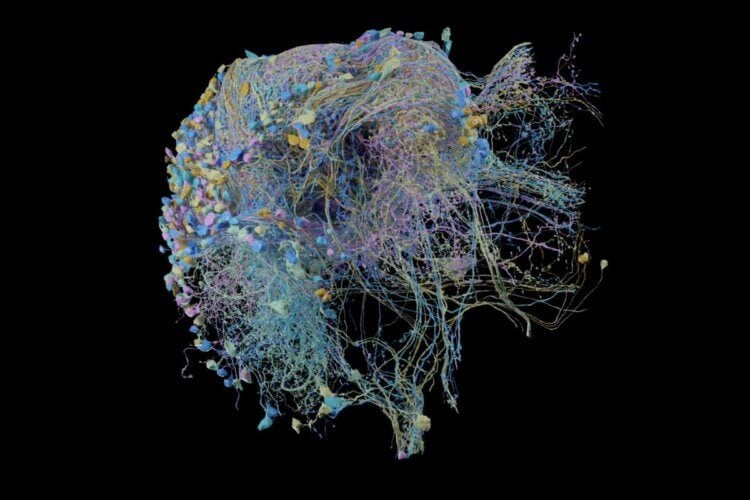 Как составить 3D-карту мозга? Так выглядит участок мозга 45-летней женщины, страдающей от эпилепсии. Фото.