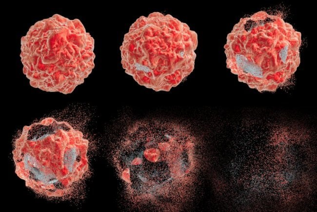 Шотландские ученые изобрели способ, с помощью которого можно убивать раковые клетки. Фото.